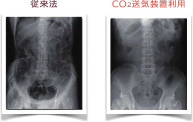 検査の違い